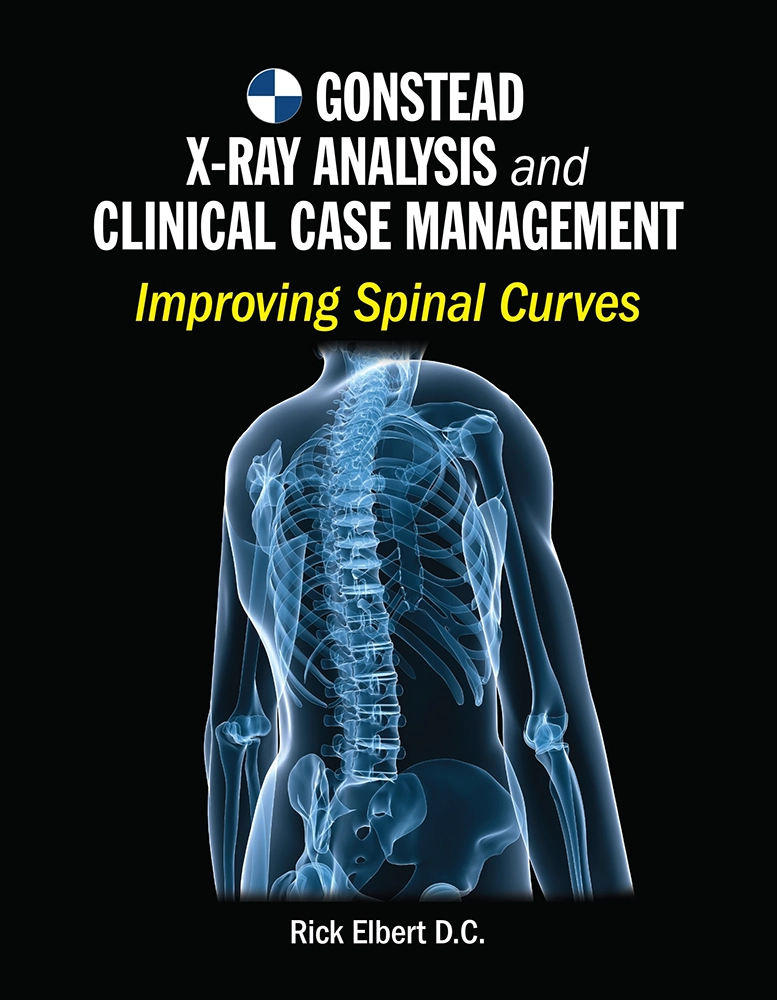 Chiropractic Ogden IA Book Cover